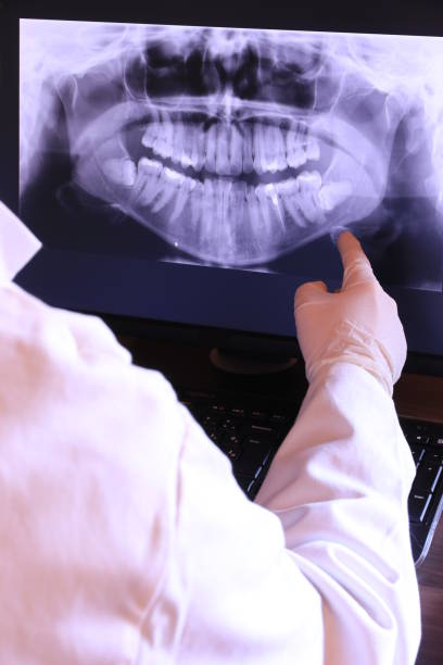 Best Broken or Chipped Tooth Repair in Takoma Park, MD