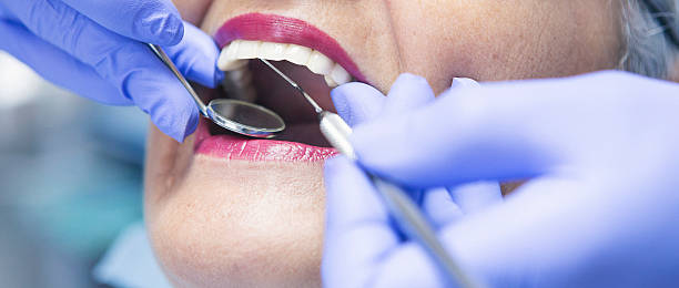Best Emergency Dental Care for Sports Injuries in Takoma Park, MD